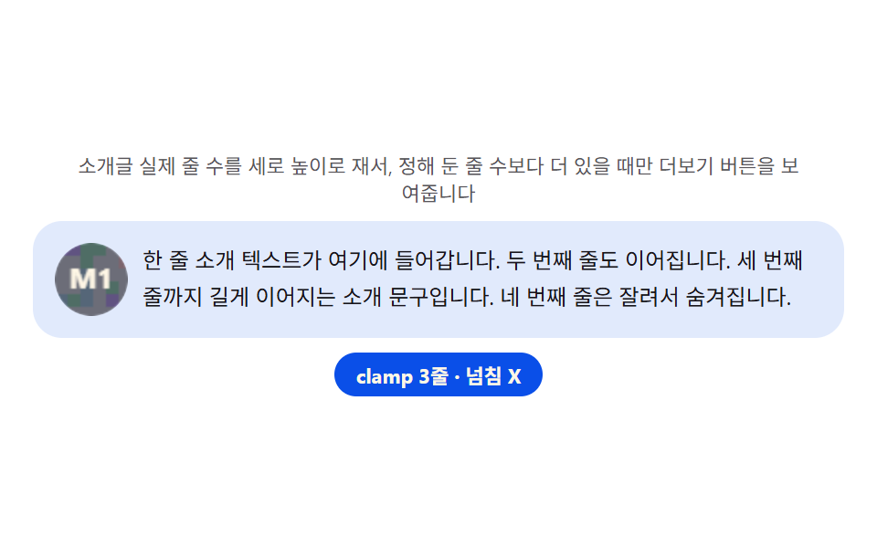 프로필 상세 — 소개글 높이를 재서 더보기 버튼 유무를 정하는 카드